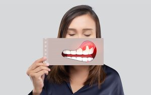 D&D Dental clinic: Patient talking to their dentist about a dental abscess